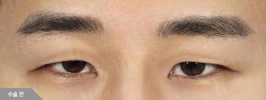 Before