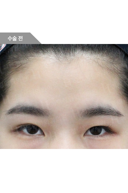 Before