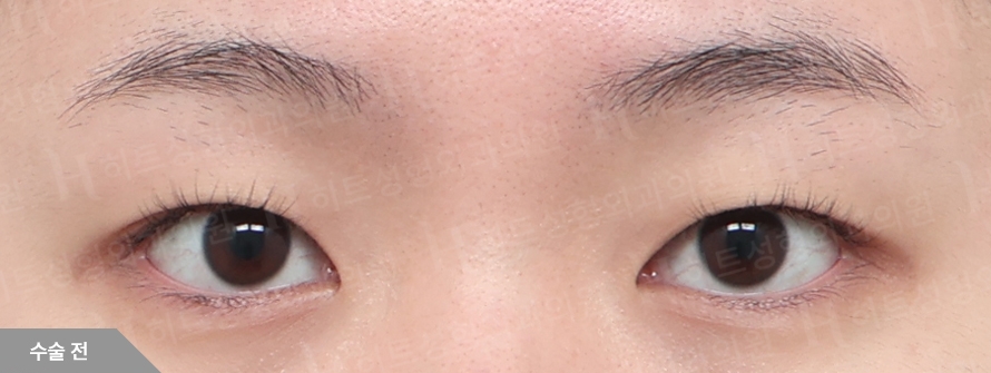 Before