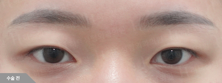 Before
