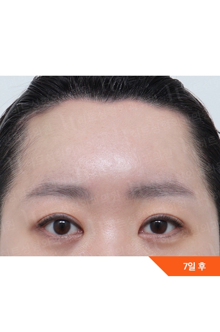 After